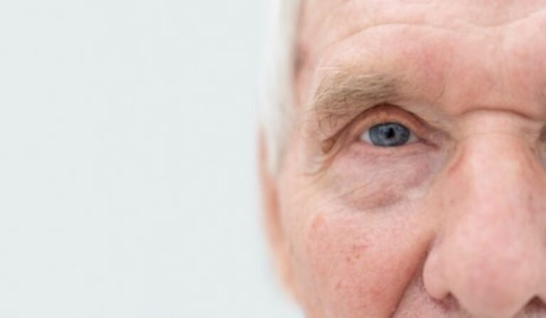 A Comprehensive Guide to Understanding and Treating Cataracts