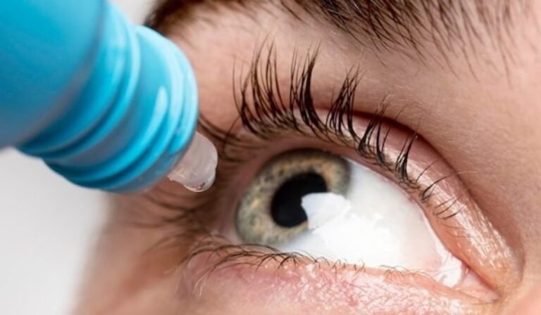 Pterygium: Nature’s Nudge to Prioritize Eye Care
